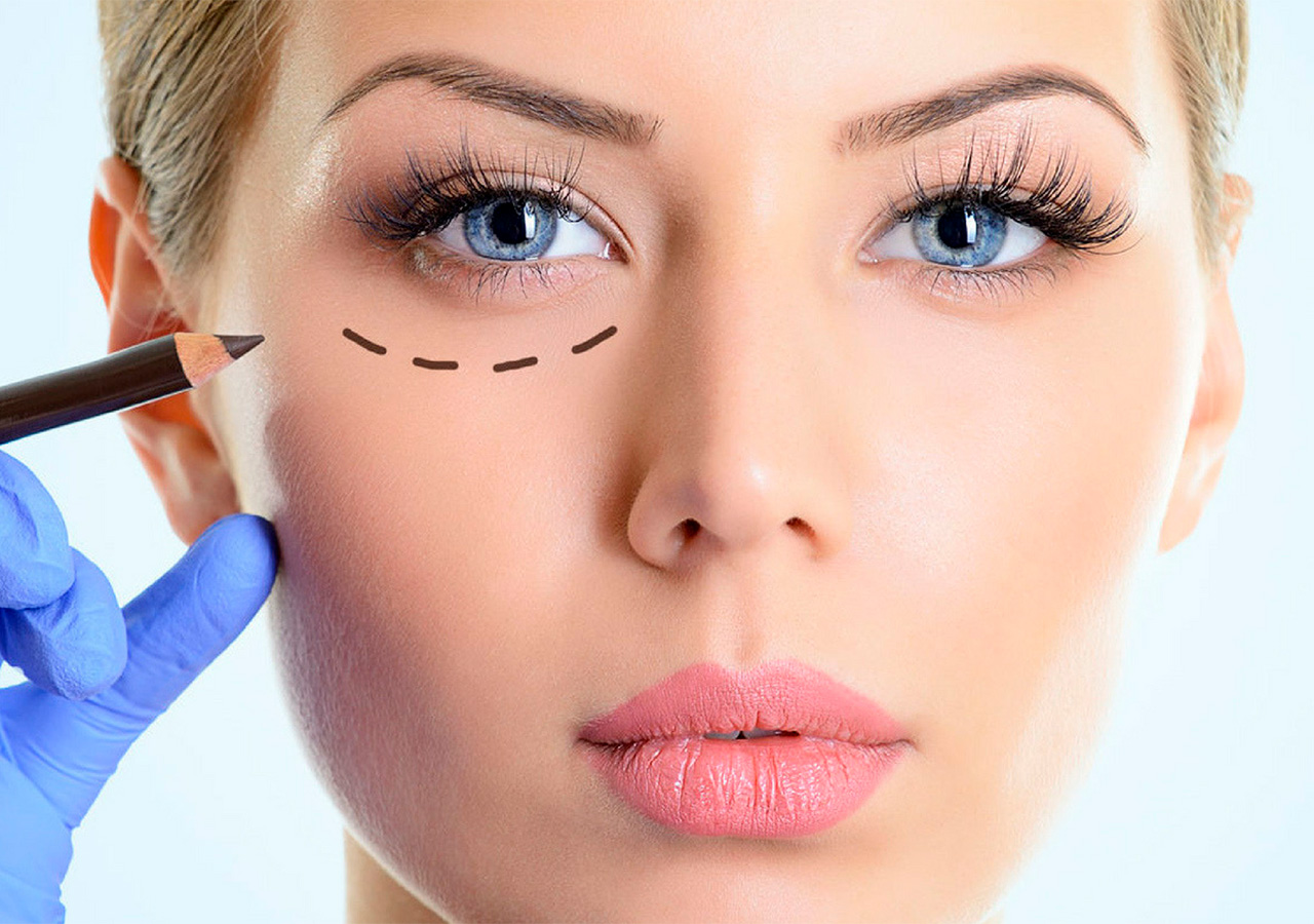 Blefaroplastia PlasticSkin