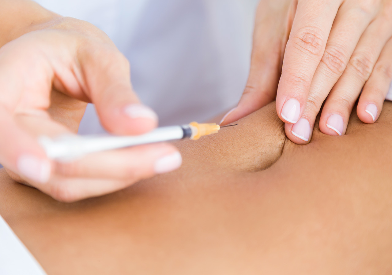 PRP (Plasma rico en plaquetas) PlasticSkin