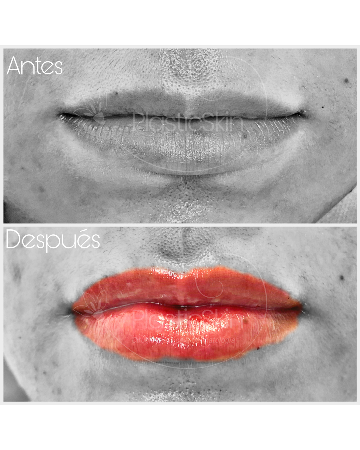 Labios