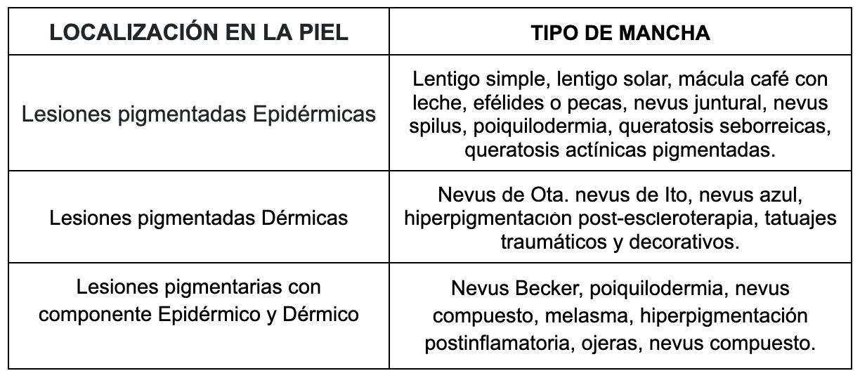 Tabla