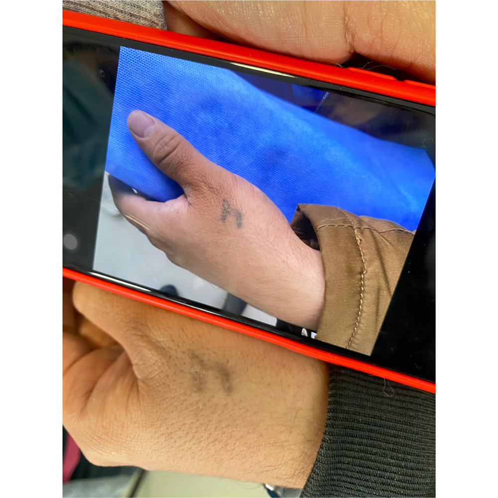 Tatuajes