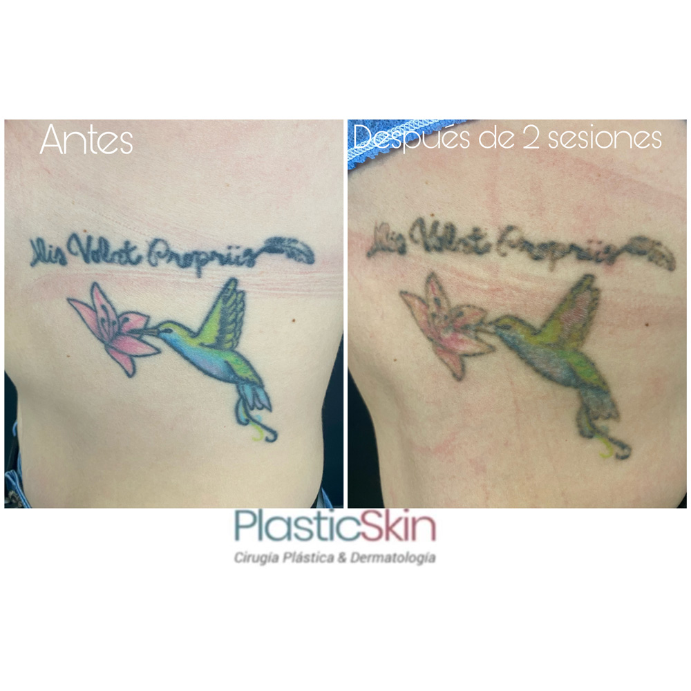 Tatuajes