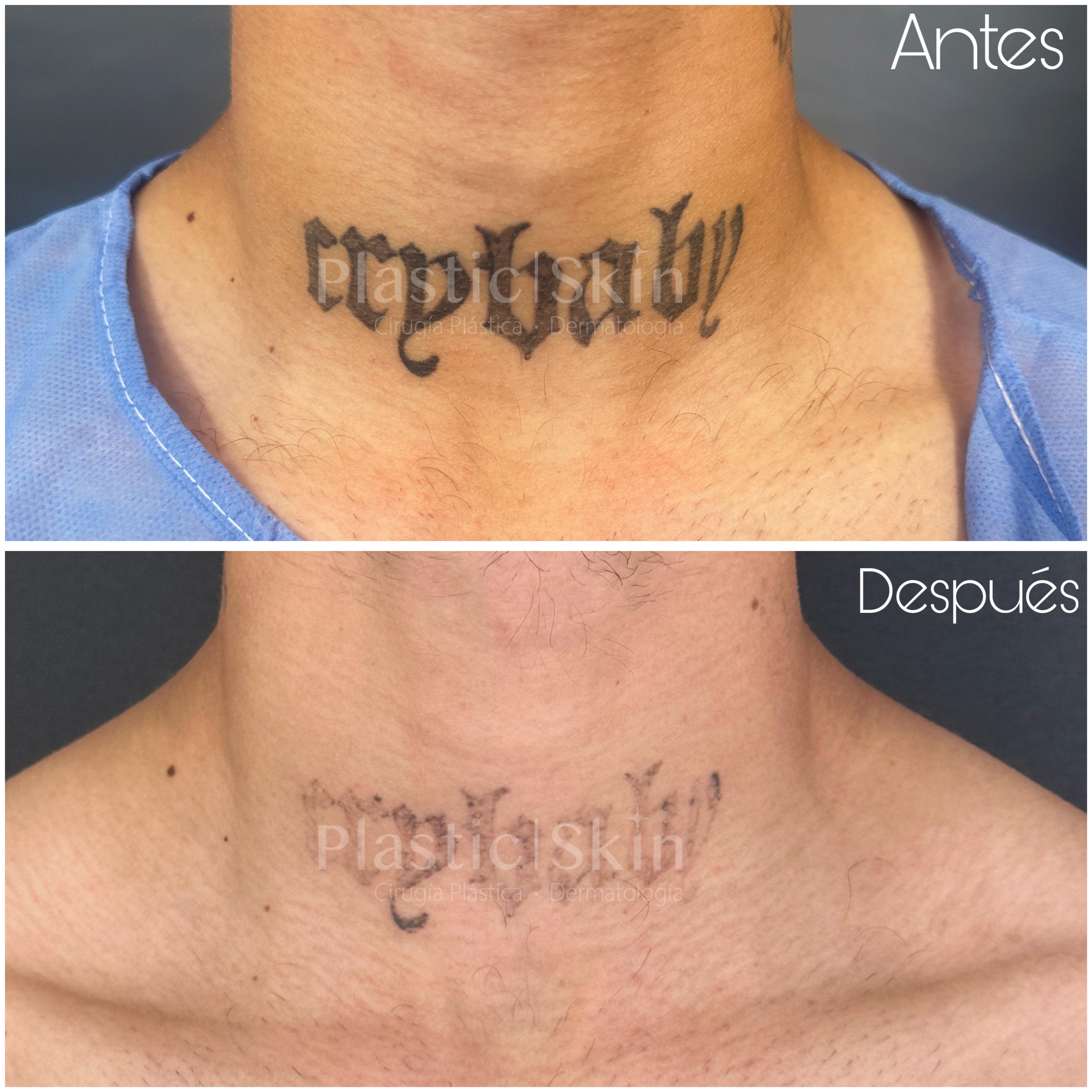 Tatuajes