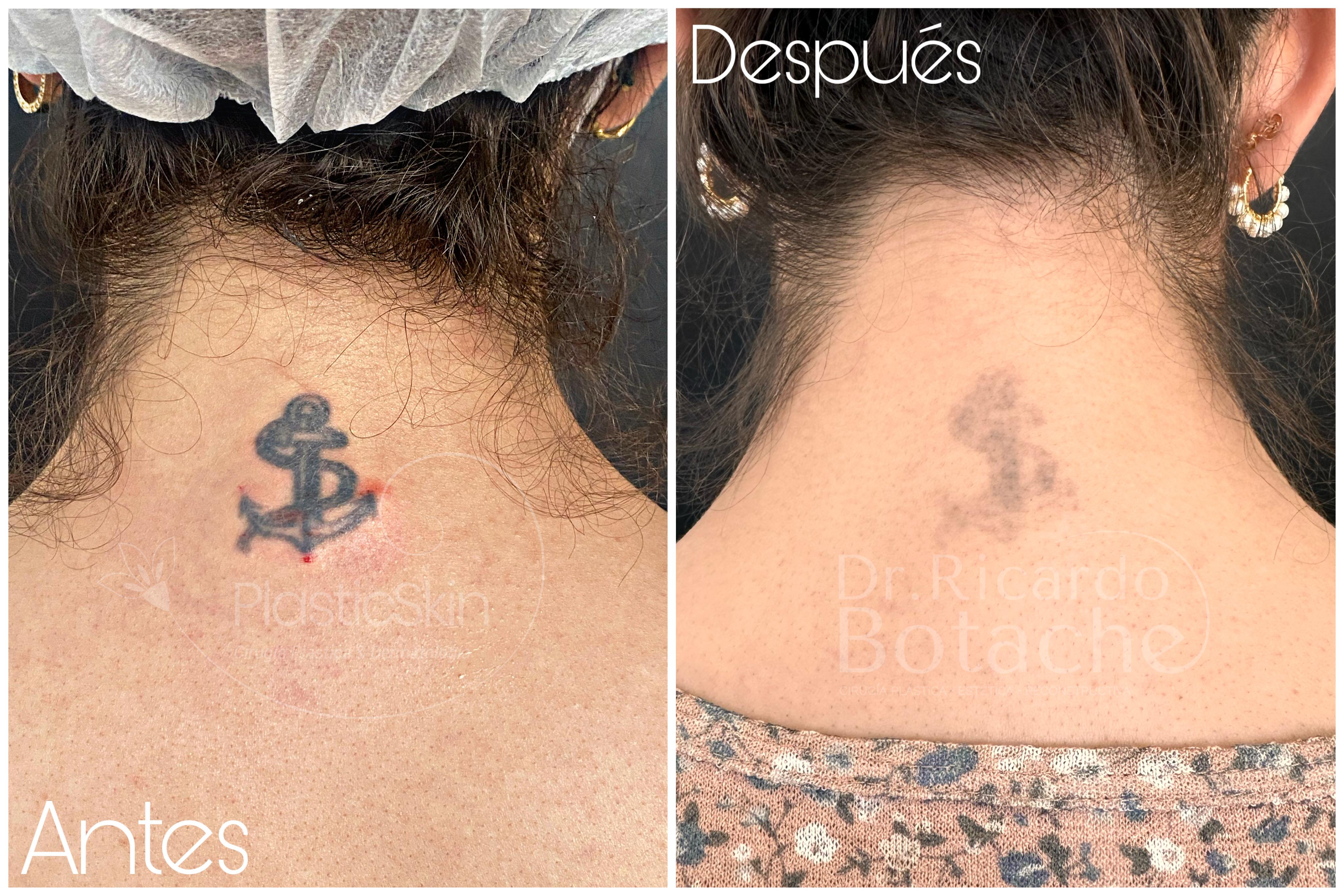 Tatuajes